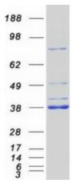 SDS-PAGE (MYD88-687HFL).jpg